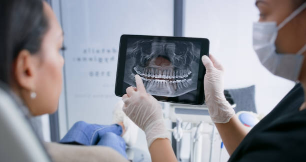 Licensed Dental Veneers service in Westworth Village, TX - Smile Center Dentistry